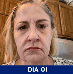 Dia-01.png